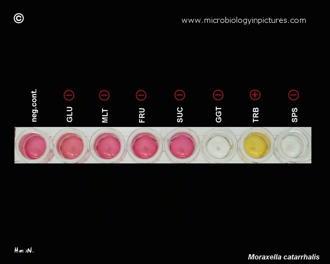 moraxella catarrhalis tests